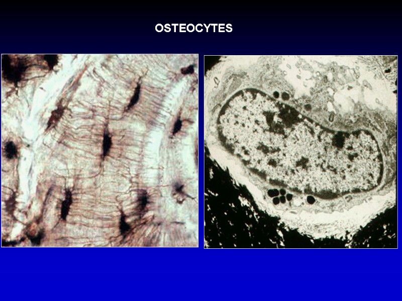 OSTEOCYTES